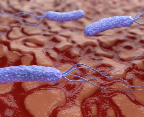 Helicobacter Pylori 10 h pylori